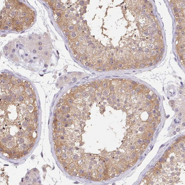 DNAJC5G Antibody in Immunohistochemistry (Paraffin) (IHC (P))