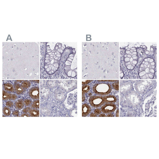 C6orf58 Antibody in Immunohistochemistry (IHC)