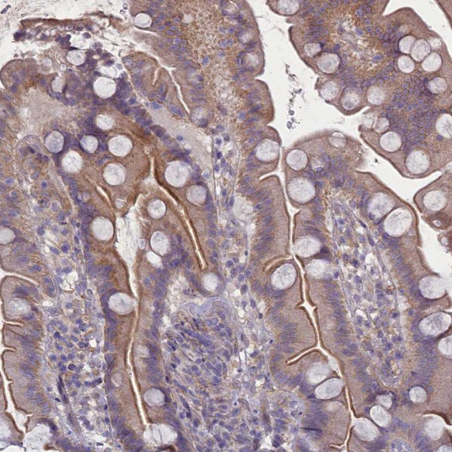 PLEKHG6 Antibody in Immunohistochemistry (Paraffin) (IHC (P))