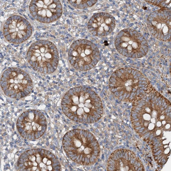 ANKRD26 Antibody in Immunohistochemistry (Paraffin) (IHC (P))