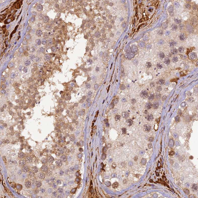 PZP Antibody in Immunohistochemistry (Paraffin) (IHC (P))