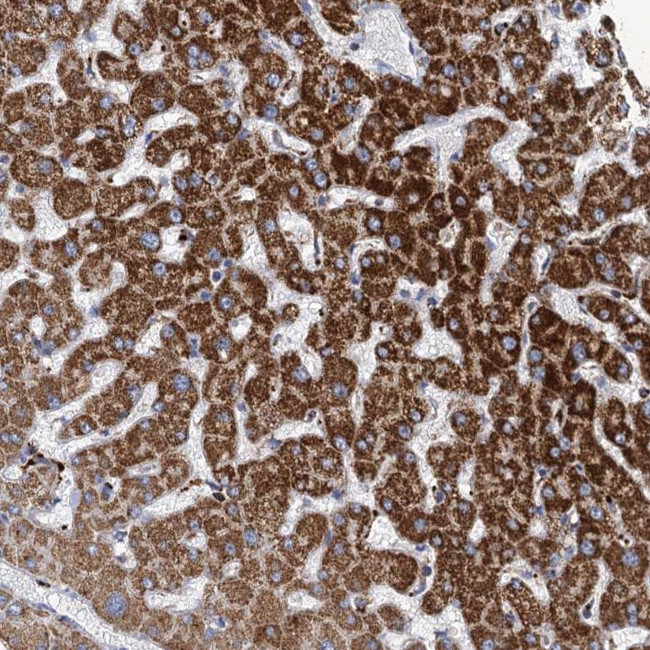 ANKS3 Antibody in Immunohistochemistry (Paraffin) (IHC (P))