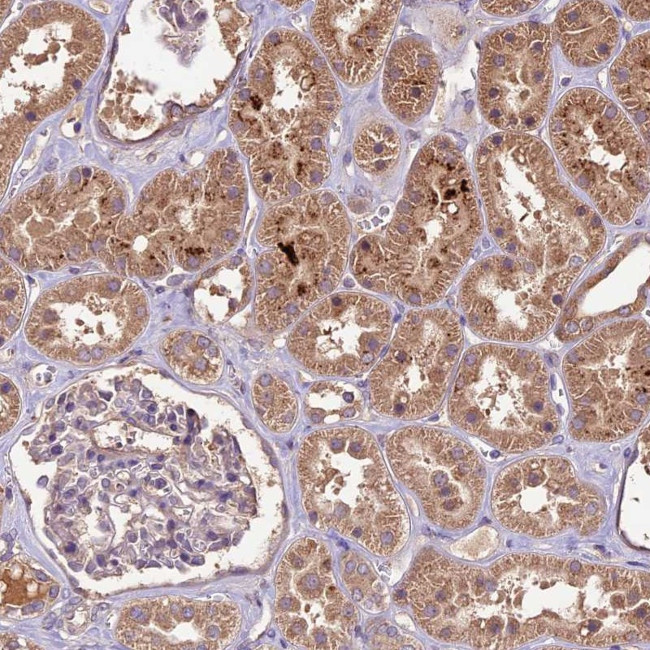 CRLF1 Antibody in Immunohistochemistry (Paraffin) (IHC (P))