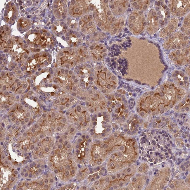 ATP10A Antibody in Immunohistochemistry (Paraffin) (IHC (P))