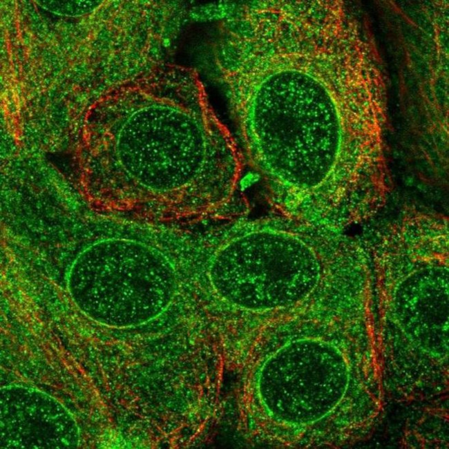 TMEM205 Antibody in Immunocytochemistry (ICC/IF)