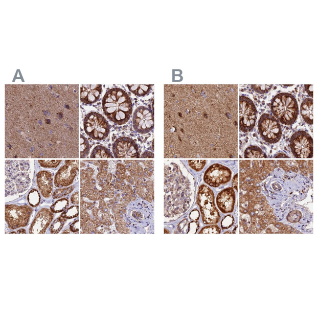 NDUFA8 Antibody in Immunohistochemistry (IHC)