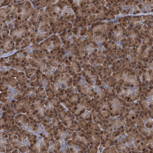 TRAC-1 Antibody in Immunohistochemistry (Paraffin) (IHC (P))