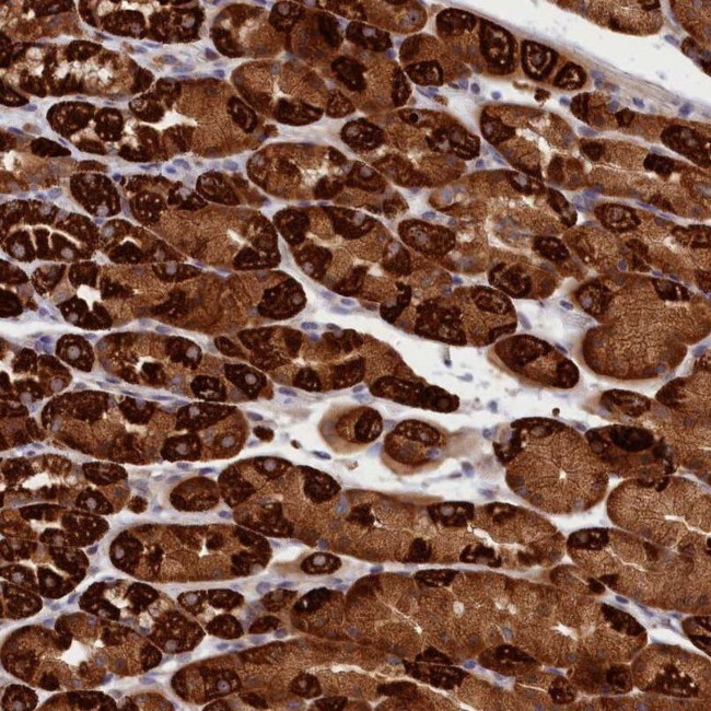 CEP44 Antibody in Immunohistochemistry (IHC)