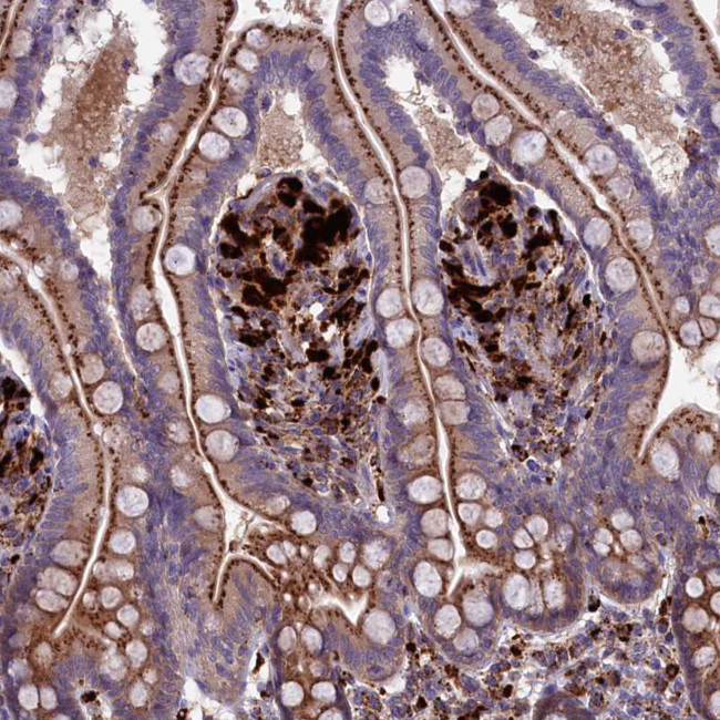 MAN2B1 Antibody in Immunohistochemistry (Paraffin) (IHC (P))