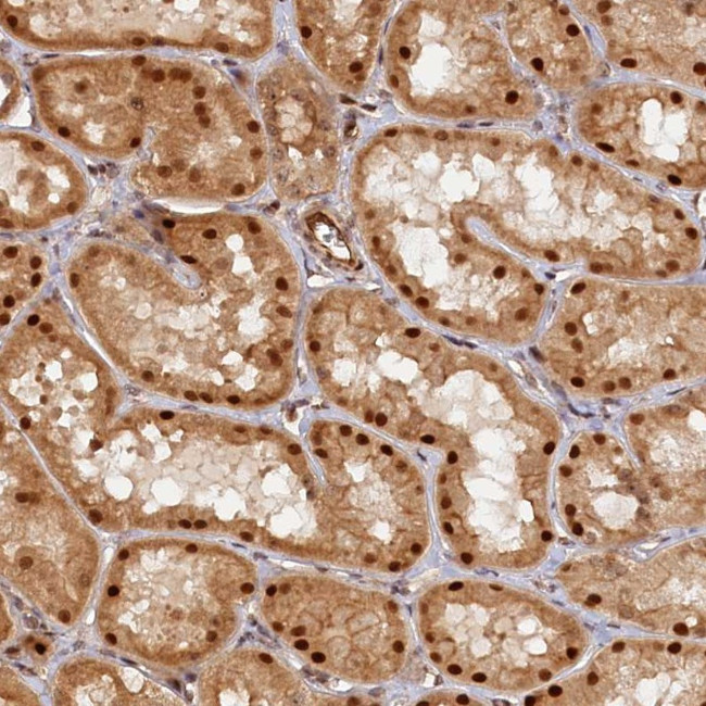 ANKRD24 Antibody in Immunohistochemistry (Paraffin) (IHC (P))