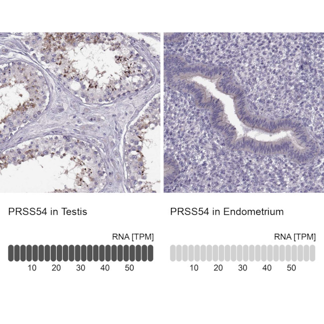 PRSS54 Antibody in Immunohistochemistry (IHC)
