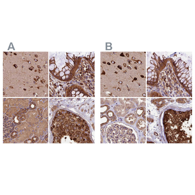 KARS Antibody in Immunohistochemistry (IHC)