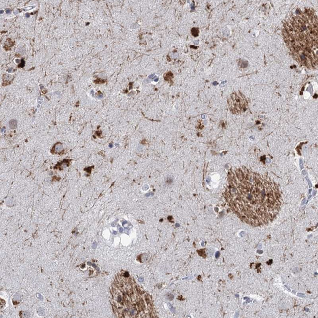 C16orf72 Antibody in Immunohistochemistry (Paraffin) (IHC (P))