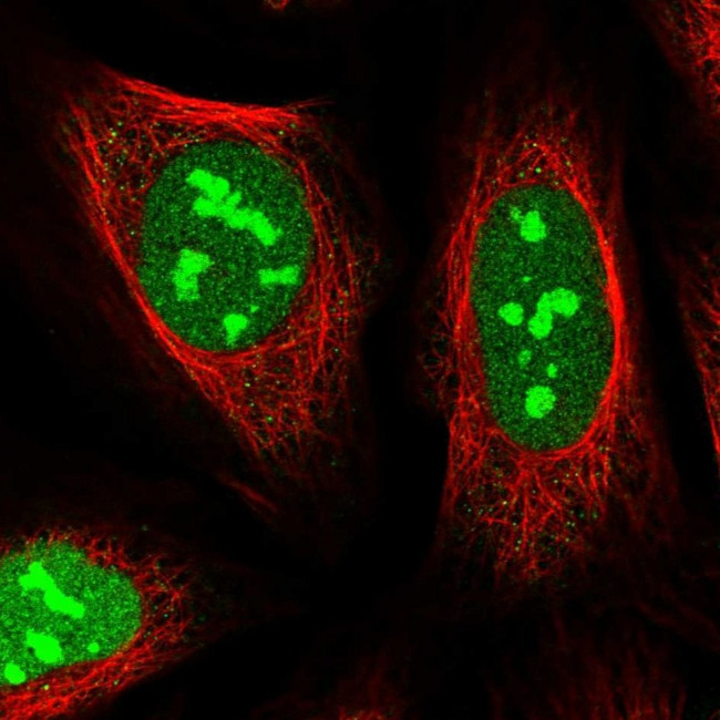TMA16 Antibody in Immunocytochemistry (ICC/IF)
