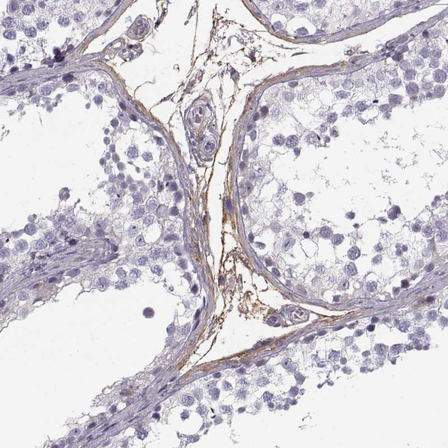 PABPC1L2A Antibody in Immunohistochemistry (Paraffin) (IHC (P))