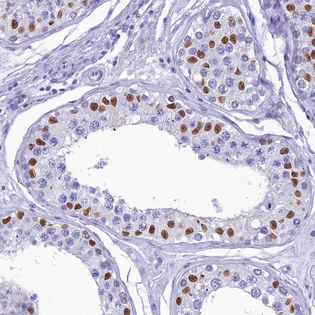 FAM169A Antibody in Immunohistochemistry (Paraffin) (IHC (P))