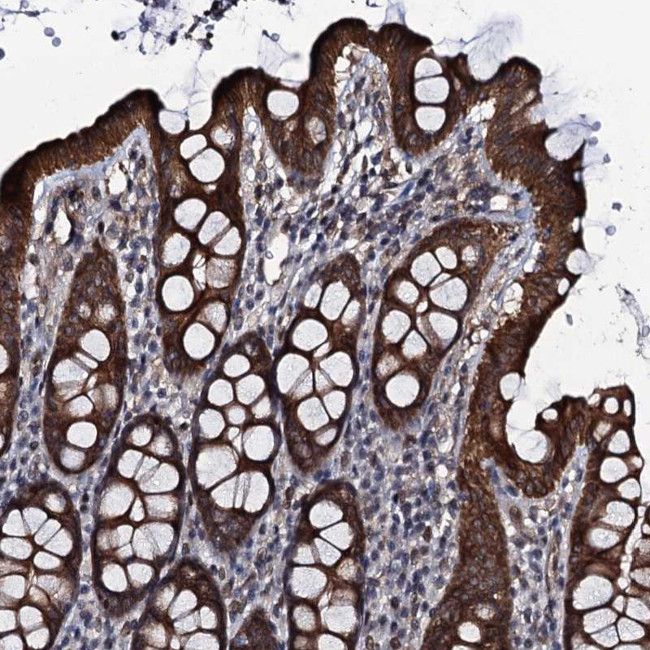 Evx2 Antibody in Immunohistochemistry (Paraffin) (IHC (P))