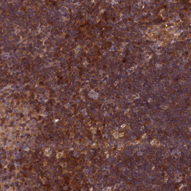 DUOXA1 Antibody in Immunohistochemistry (Paraffin) (IHC (P))