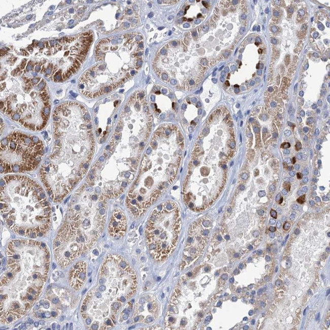 TMEM221 Antibody in Immunohistochemistry (Paraffin) (IHC (P))
