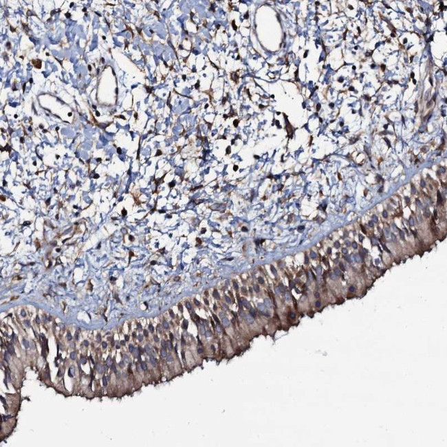 KXD1 Antibody in Immunohistochemistry (Paraffin) (IHC (P))