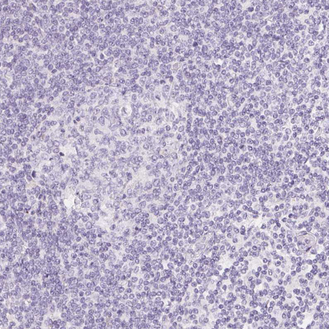 SGLT2 Antibody in Immunohistochemistry (Paraffin) (IHC (P))