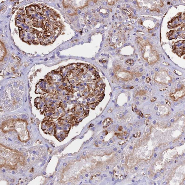 TTC4 Antibody in Immunohistochemistry (Paraffin) (IHC (P))