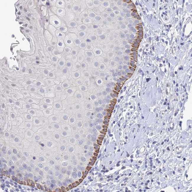 FAM86A Antibody in Immunohistochemistry (Paraffin) (IHC (P))