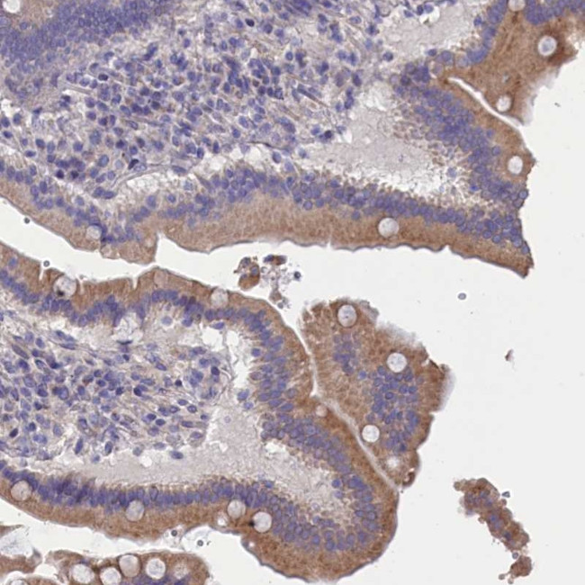 CYP2U1 Antibody in Immunohistochemistry (Paraffin) (IHC (P))