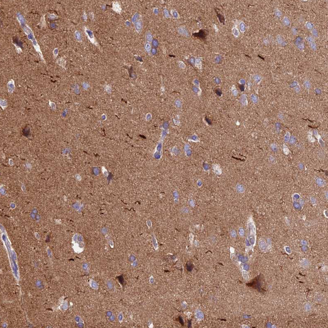 ANO3 Antibody in Immunohistochemistry (Paraffin) (IHC (P))