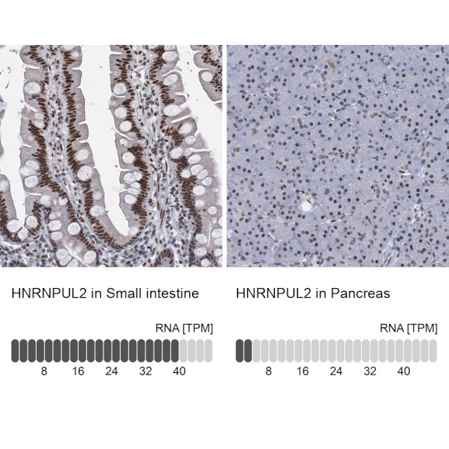 hnRNP UL2 Antibody in Immunohistochemistry (IHC)