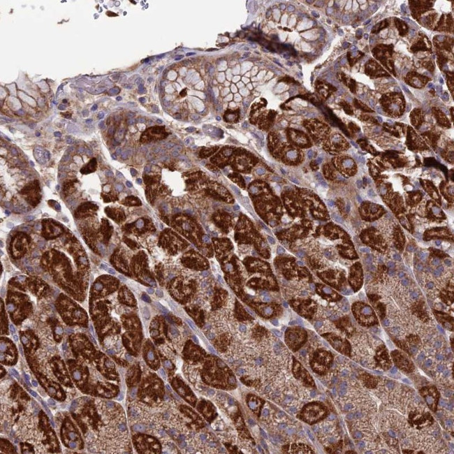 SLC15A5 Antibody in Immunohistochemistry (Paraffin) (IHC (P))
