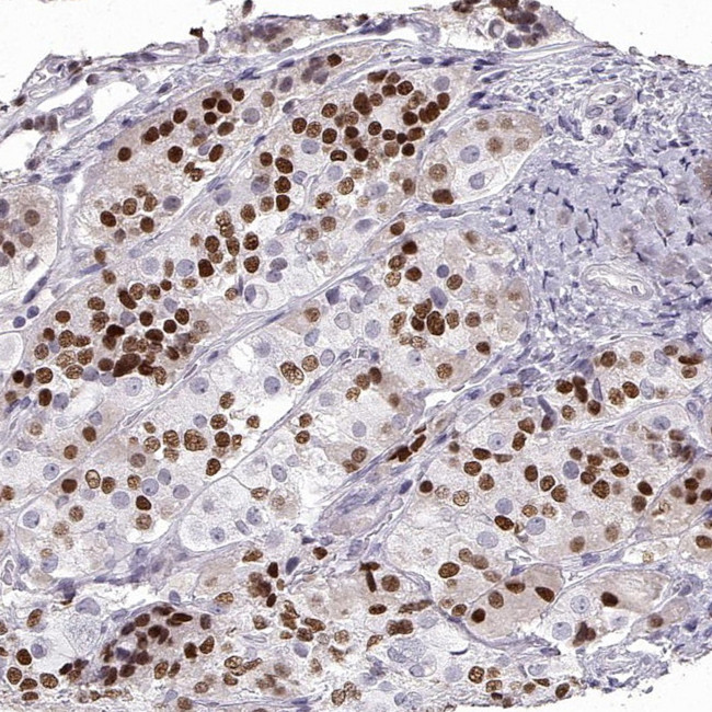 PIT1 Antibody in Immunohistochemistry (IHC)