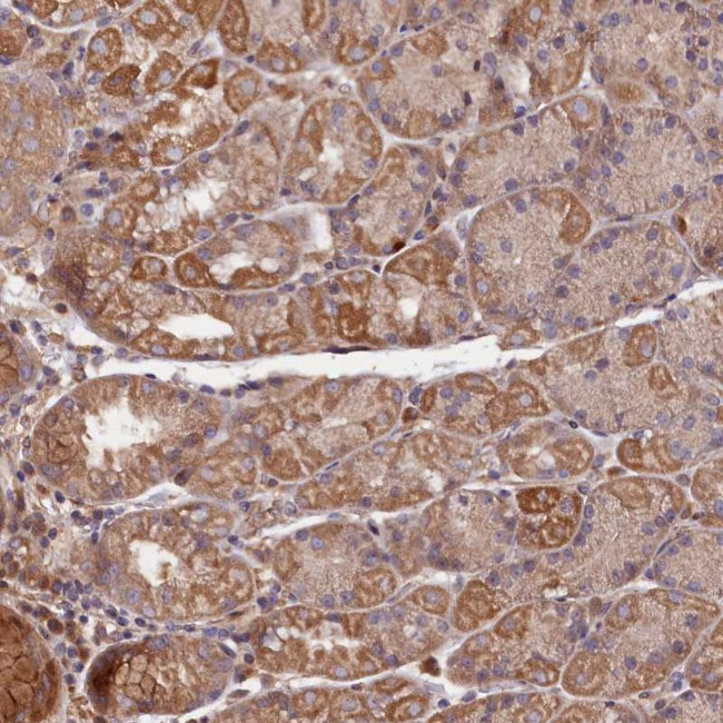 GREB1L Antibody in Immunohistochemistry (Paraffin) (IHC (P))