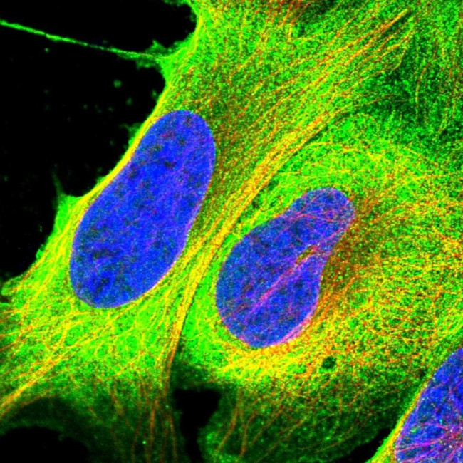 RASAL1 Antibody in Immunocytochemistry (ICC/IF)