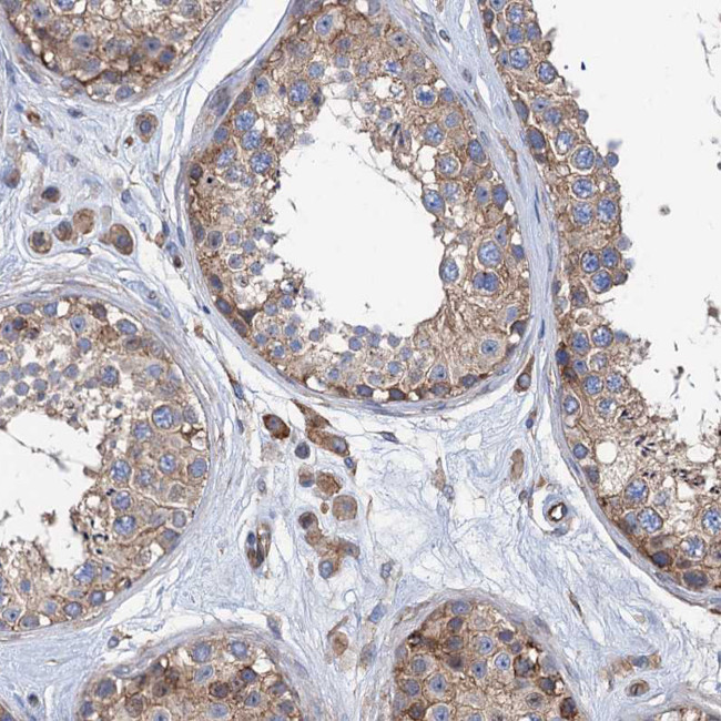 KCC4 Antibody in Immunohistochemistry (IHC)