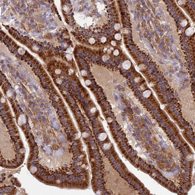 Coronin 7 Antibody in Immunohistochemistry (Paraffin) (IHC (P))