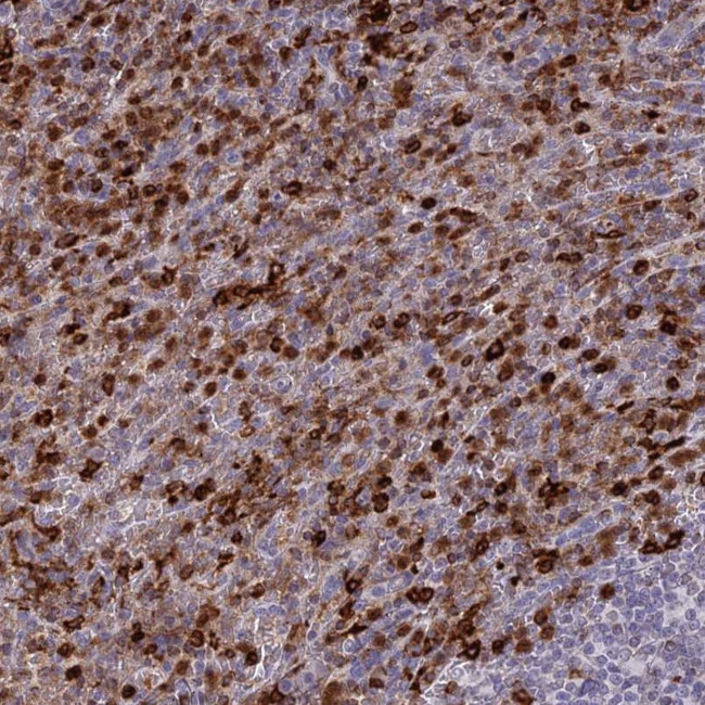 APOB48R Antibody in Immunohistochemistry (Paraffin) (IHC (P))