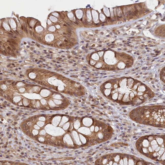 C19orf44 Antibody in Immunohistochemistry (Paraffin) (IHC (P))