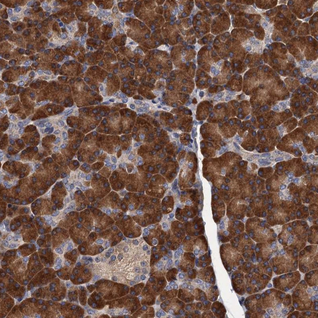 RGS11 Antibody in Immunohistochemistry (Paraffin) (IHC (P))
