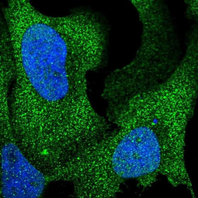 ARHGAP17 Antibody in Immunocytochemistry (ICC/IF)