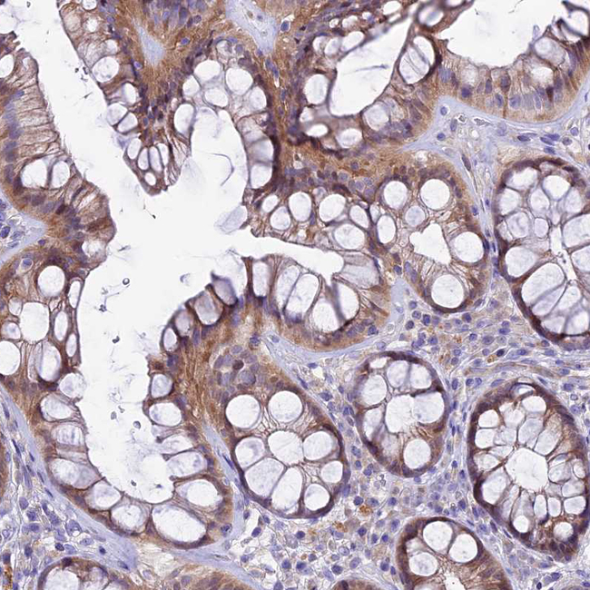 PIGU Antibody in Immunohistochemistry (Paraffin) (IHC (P))