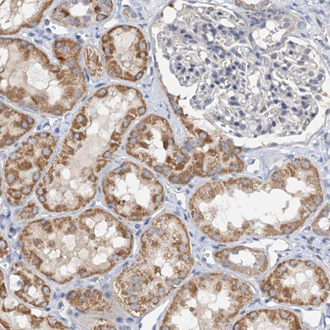 ZNF606 Antibody in Immunohistochemistry (Paraffin) (IHC (P))