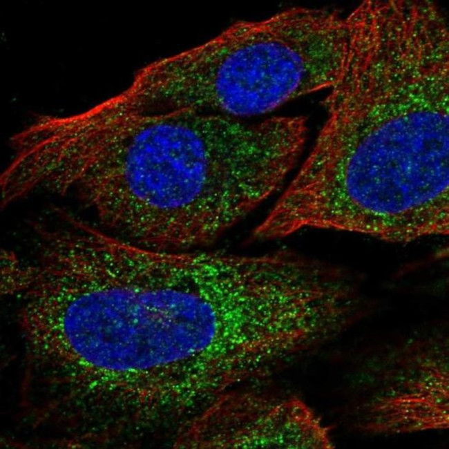 CCDC184 Antibody in Immunocytochemistry (ICC/IF)