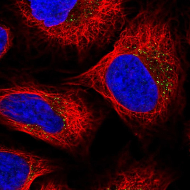 SULT2B1 Antibody in Immunocytochemistry (ICC/IF)