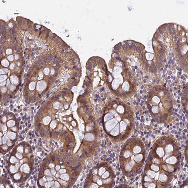 FAM98C Antibody in Immunohistochemistry (Paraffin) (IHC (P))