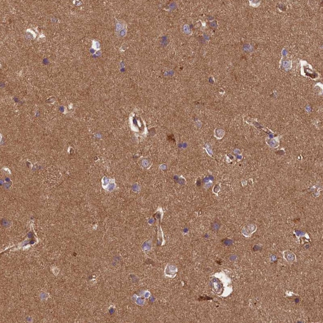 C6orf70 Antibody in Immunohistochemistry (Paraffin) (IHC (P))