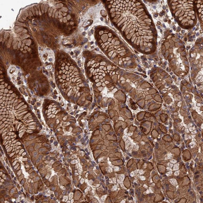DEF8 Antibody in Immunohistochemistry (Paraffin) (IHC (P))