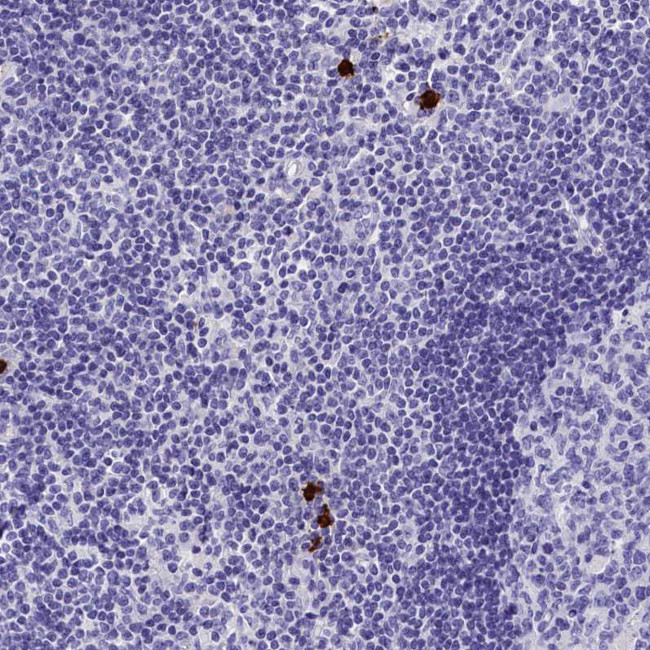 Galectin 10 Antibody in Immunohistochemistry (Paraffin) (IHC (P))
