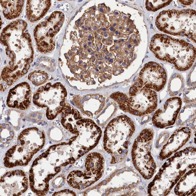 LDHD Antibody in Immunohistochemistry (Paraffin) (IHC (P))