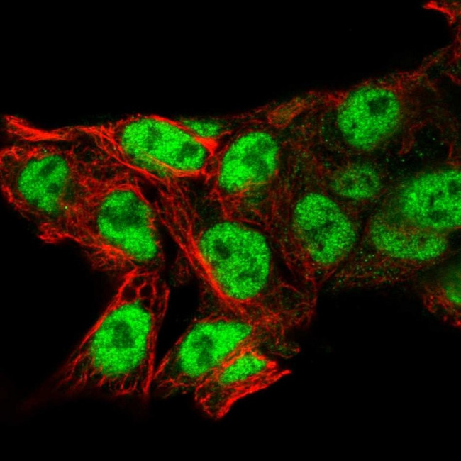 CT112 Antibody in Immunocytochemistry (ICC/IF)